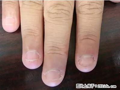 剪指甲、挖耳屎，这些日常小动作竟隐藏大危害！ - 济源生活资讯 - 济源28生活网 jiyuan.28life.net